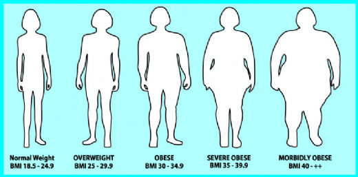 Obezite Hesaplama